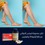 الباقة الرياضية المميزة (أوميغا 3 + كوإنزيم Q10) - دعم متكامل للدوالي والأداء الرياضي – Image 3